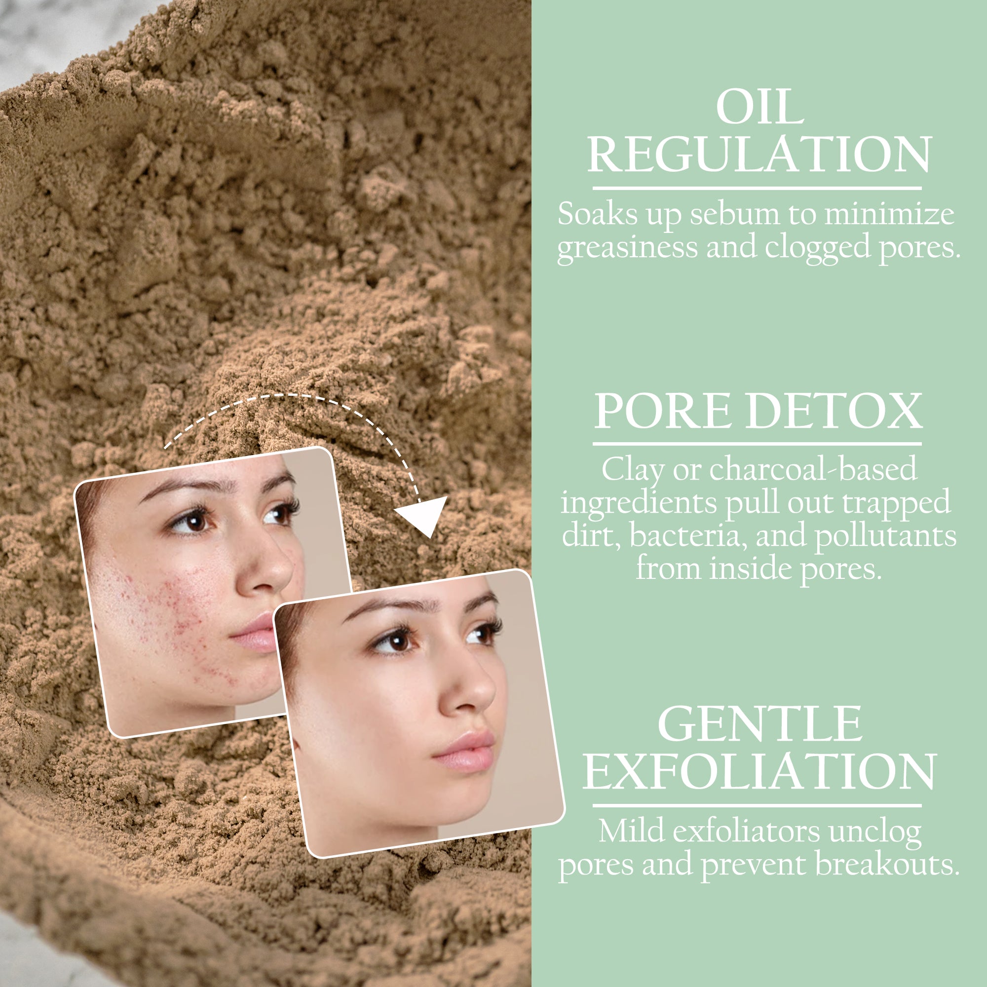 Maxerra Acne Care Mask | Neem, Clay & Liquorice | 200g