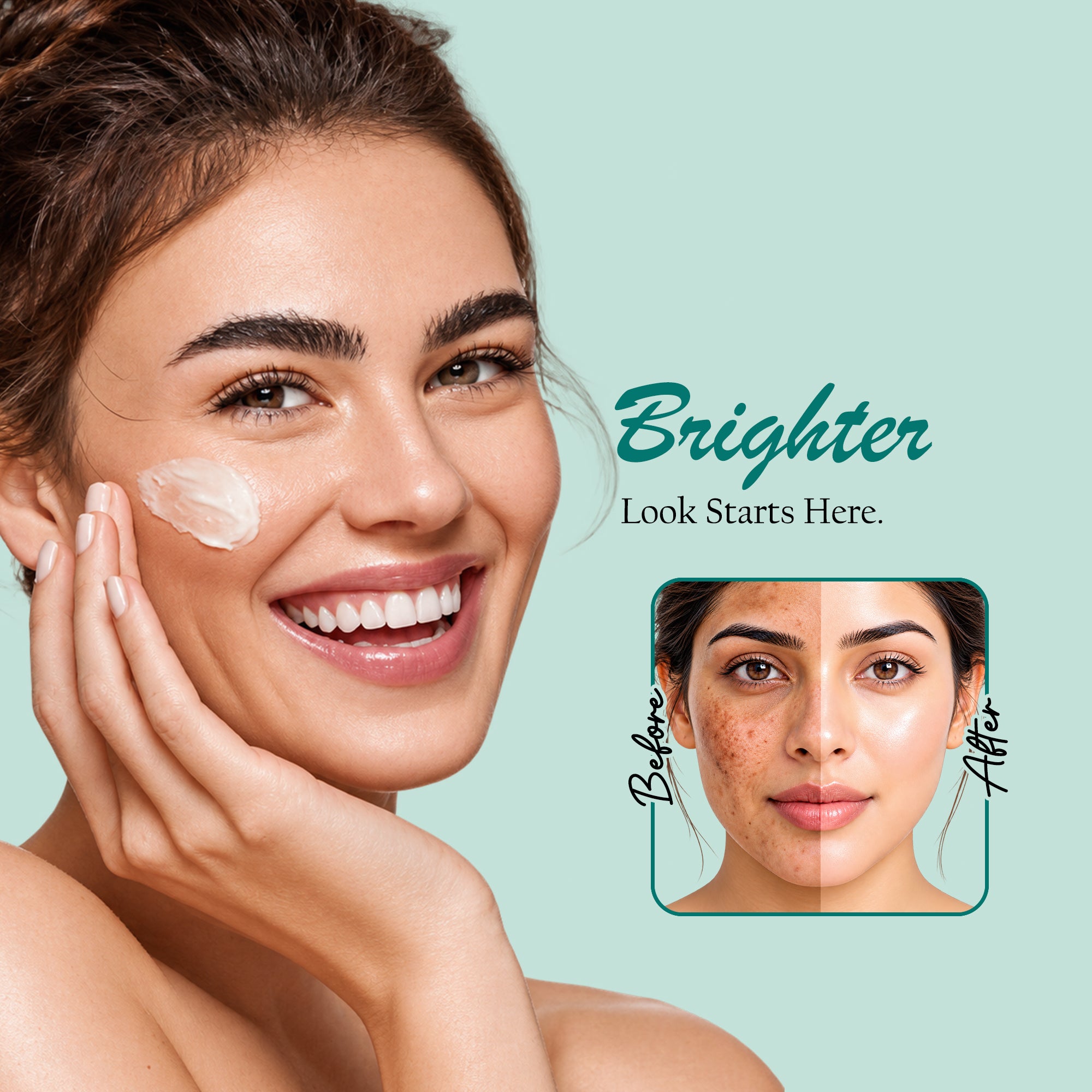 Pigmentation Cream for Dark Spots | Maxerra 100g